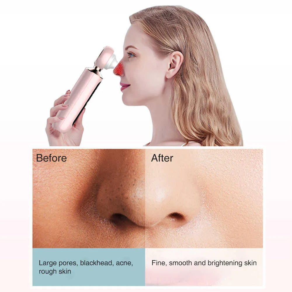 Glam Mania™ Blackhead Suction Machine