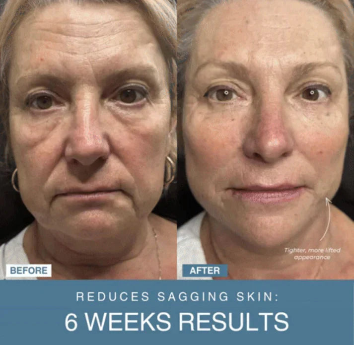 Glam Mania™ 7-in-1 LED Anti-Aging/Wrinkle Apparatus