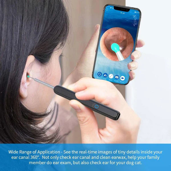Glam Mania™Smart Ear Cleaning Device