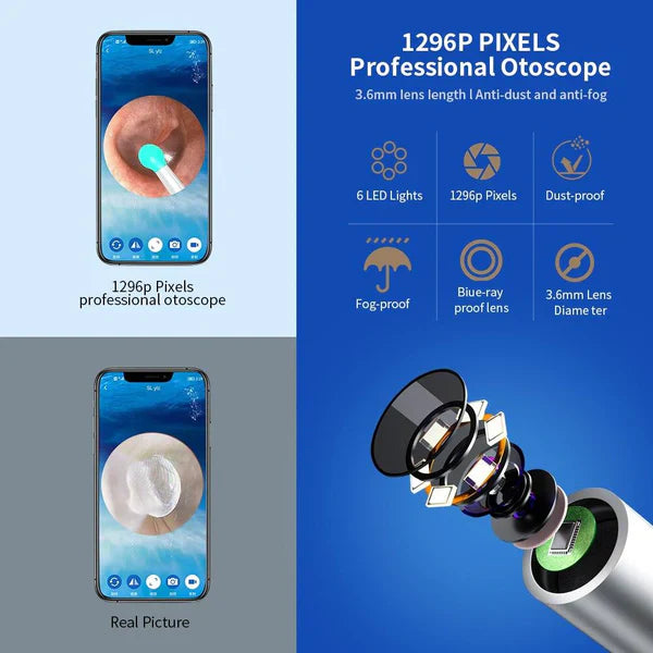 Glam Mania™Smart Ear Cleaning Device